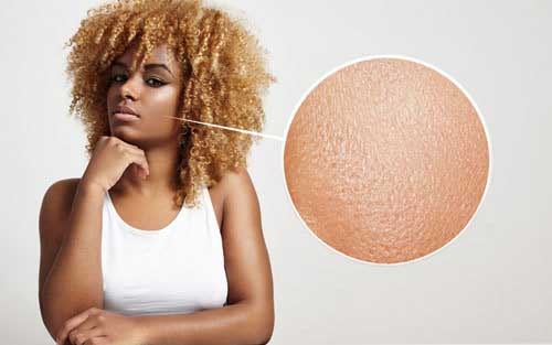 peeling-peau-du-visage-pore-dilate-1308743